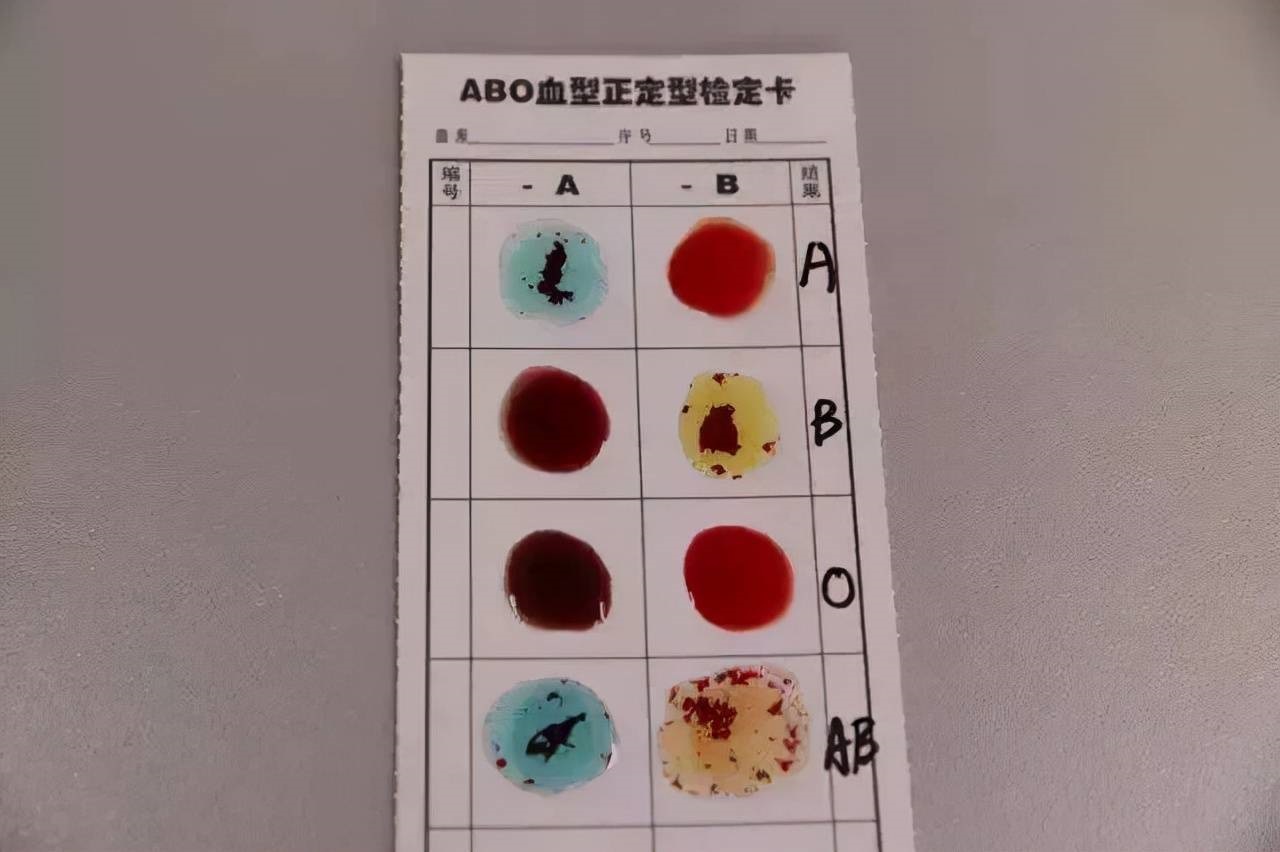 血型能判断亲子关系？关于南京亲子鉴定的五大误区