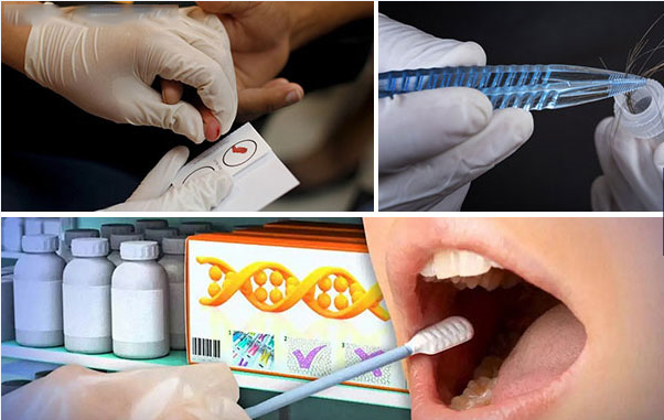 样本采集有讲究：在南京自行采集毛发、指甲等样本注意事项